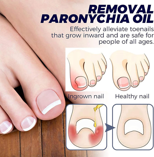 ToePerfect™ Intensieve verzorging voor verzorgde teennagels en handnagels [1 + 1 Gratis]