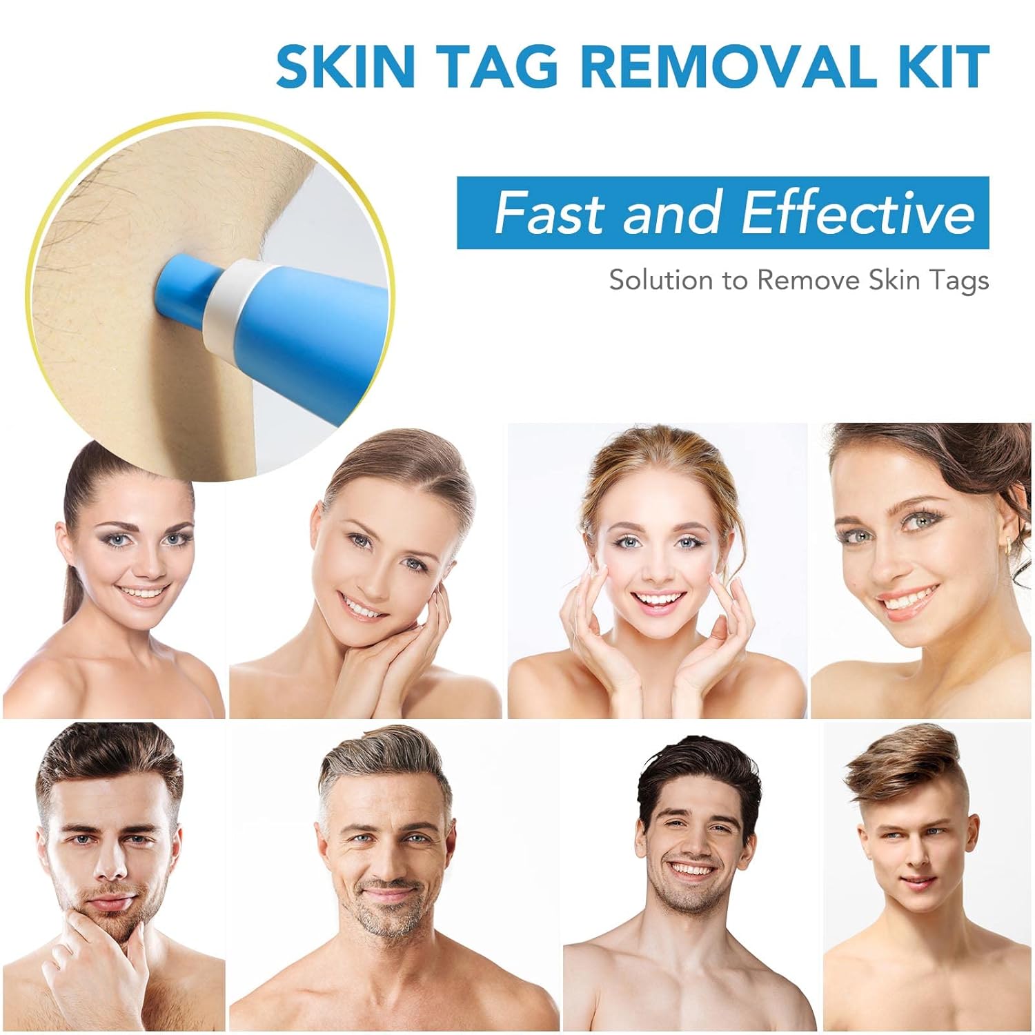 DermaFix™ - Kit voor geavanceerde wratverwijdering [1 + 1 Gratis]