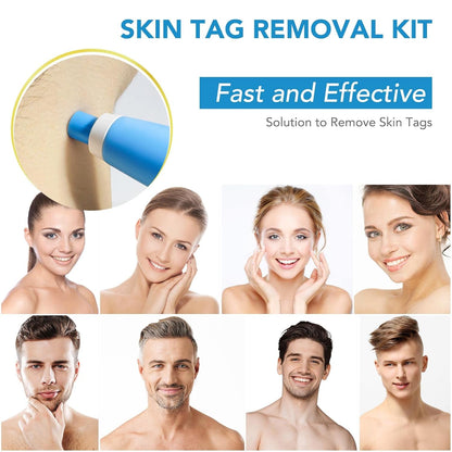 DermaFix™ - Kit voor geavanceerde wratverwijdering [1 + 1 Gratis]