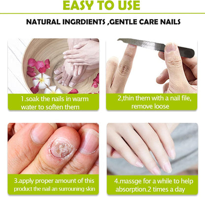 RejuveNail™ – Nagelgel tegen Schimmel & Broze Nagels [1 + 1 Gratis]