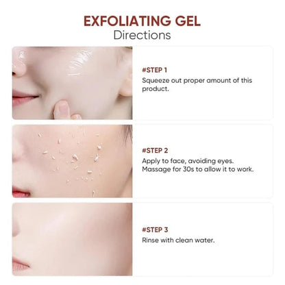 SkinPolish™ Peelinggel – Gladde, Stralende Huid & Minder Donkere Vlekken [1+1 Gratis]