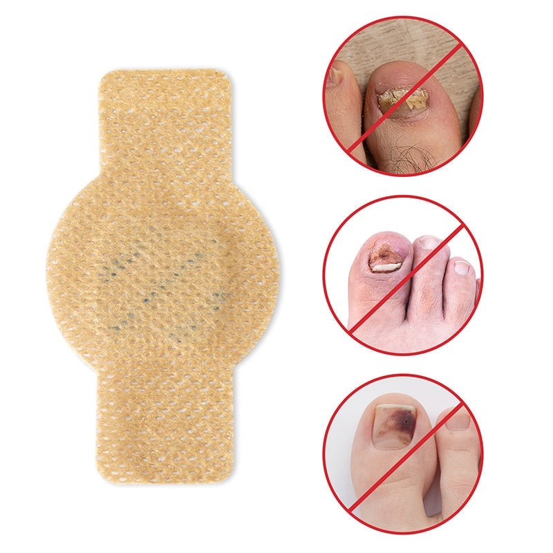 FungalPatch™ – Schimmelnagel Patch voor Snelle & Zichtbare Nagelverzorging