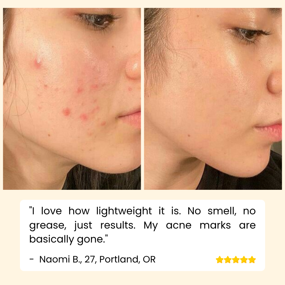 Eelhoe™ – Eternity Vitamin C Serum voor gezicht, handen & lichaam voor stralende huid [1 + 1 Gratis]