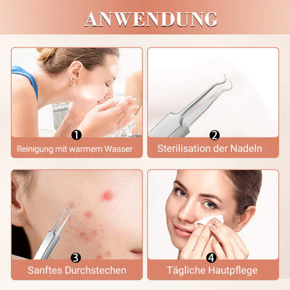 ClearSkin™ – Precieze mee-eterverwijdering voor een gladde, zuivere en stralende huid [50% Korting]