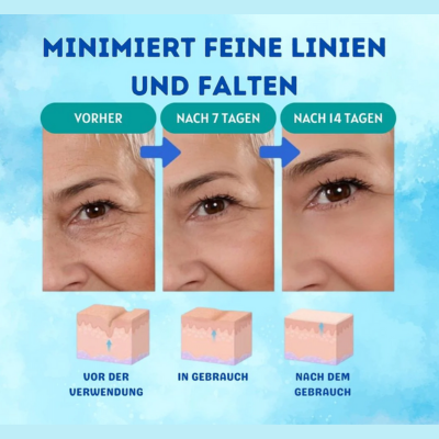YouthGlow™ – Botoxvrij anti-aging serum voor stralende, jeugdige huid [1 + 1 Gratis]
