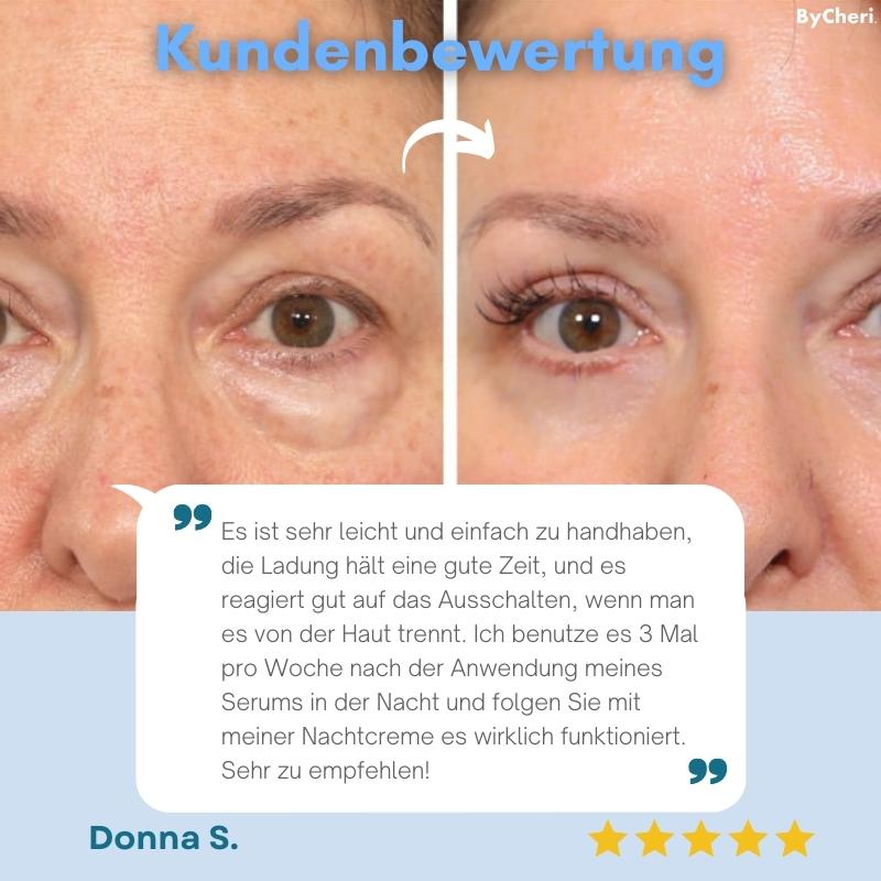 FreshEyes™ – Vermindert donkere kringen onder de ogen in seconden voor stralende frisheid [50% Korting]