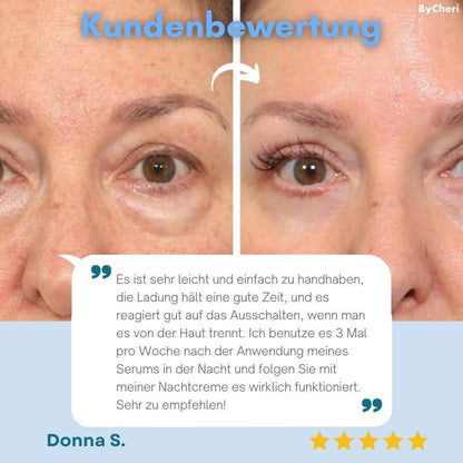 FreshEyes™ – Vermindert donkere kringen onder de ogen in seconden voor stralende frisheid [50% Korting]