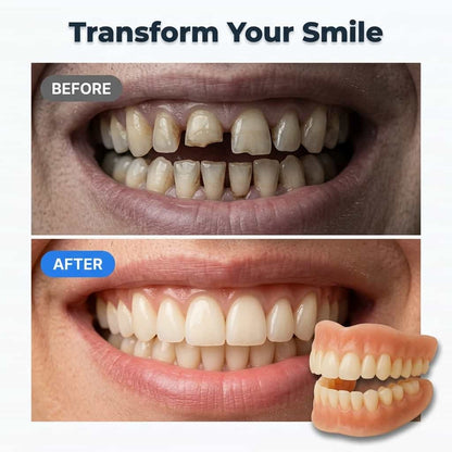 CustomDenture – Natuurlijk mooie tanden zonder lijm – 50% korting
