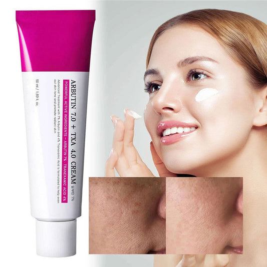 Elyzura™ – Crème tegen donkere vlekken zacht, effectief, verhelderend en zichtbaar [1 + 1 Gratis]