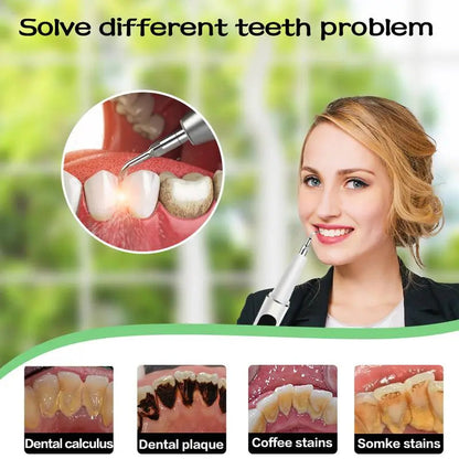 ProClean™ – Ultrasone tandenreiniger, verwijdert effectief koffie- en rookverkleuringen [50% Korting]