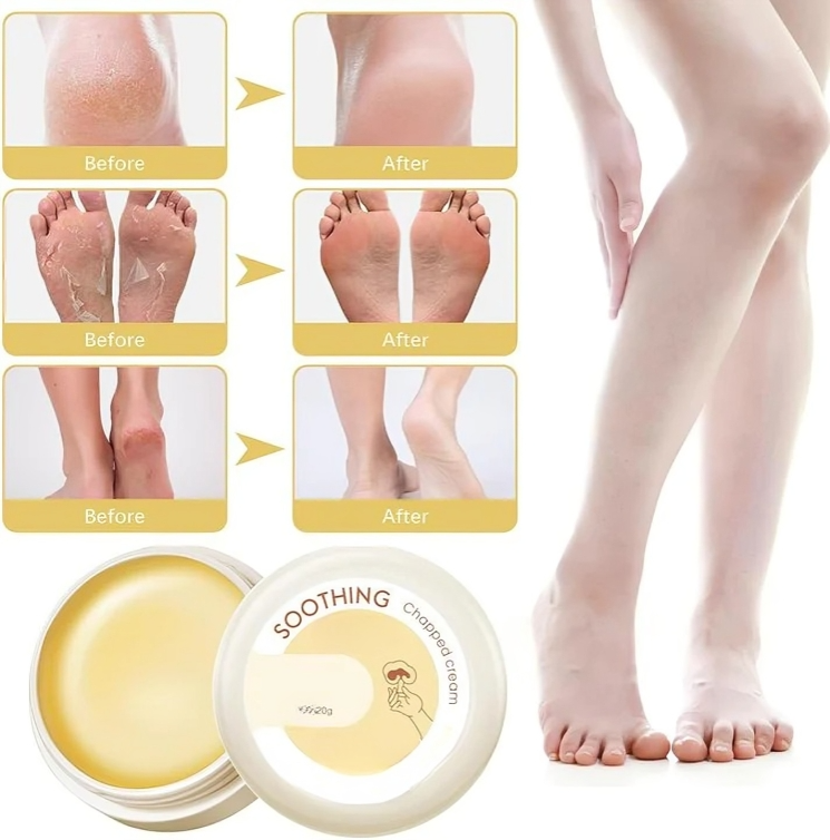 HydraHeel™ – Verzorgende en kalmerende crème voor dagelijkse verlichting [1 + 2 Gratis]