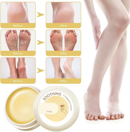 HydraHeel™ – Verzorgende en kalmerende crème voor dagelijkse verlichting [1 + 2 Gratis]