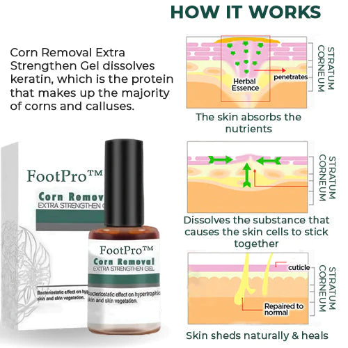 FootPro™ - Likdoornverwijdering Extra Sterke Gel [1 + 1 Gratis]