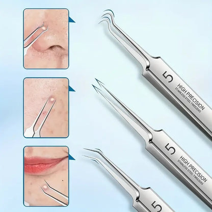 ClearPore™ Mee-eter Verwijderset – Professioneel Pincet voor Acne & Poriën