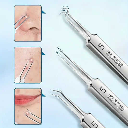 ClearPore™ – Mee-eter pincet verwijderset, nauwkeurig, effectief, veilig & hygiënisch [1 + 1 Gratis]