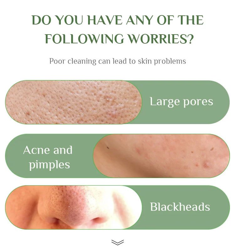 DermaTea™ – Groene Thee Masker Stick voor Diepe Poriënreiniging [1+1 Gratis]