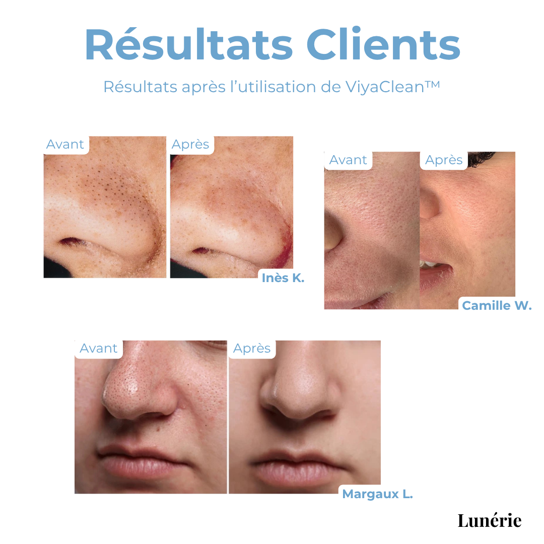 SkinClear™ – Diep reinigend serum met salicylzuur en natuurlijke extracten [50% Korting]