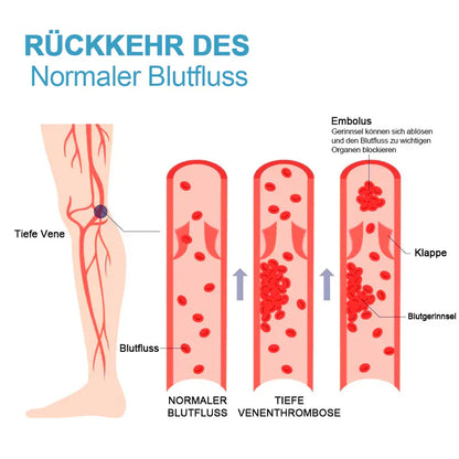 SlimSock™ - Toermalijn Ionische stretch kousen | 1 + 2 GRATIS