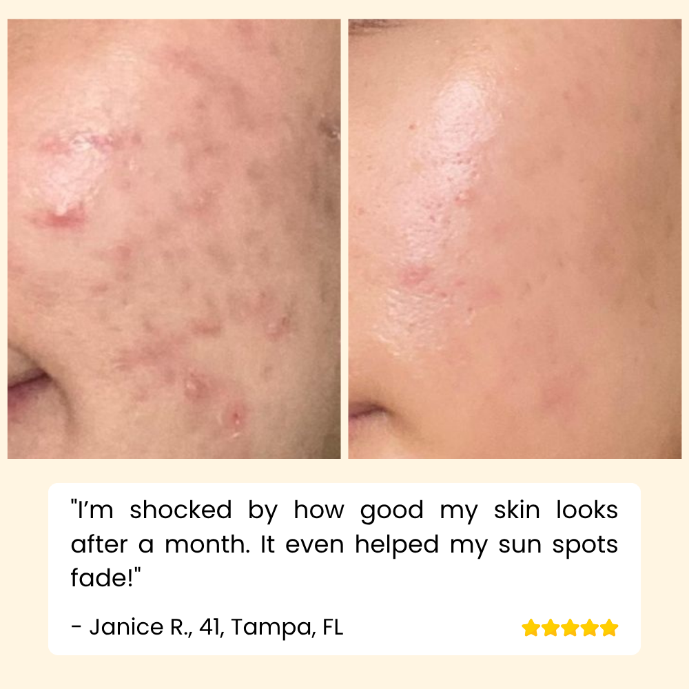 Eelhoe™ – Eternity Vitamin C Serum voor gezicht, handen & lichaam voor stralende huid [1 + 1 Gratis]