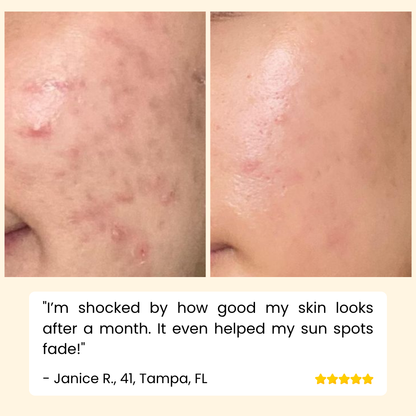 Eelhoe™ – Eternity Vitamin C Serum voor gezicht, handen & lichaam voor stralende huid [1 + 1 Gratis]