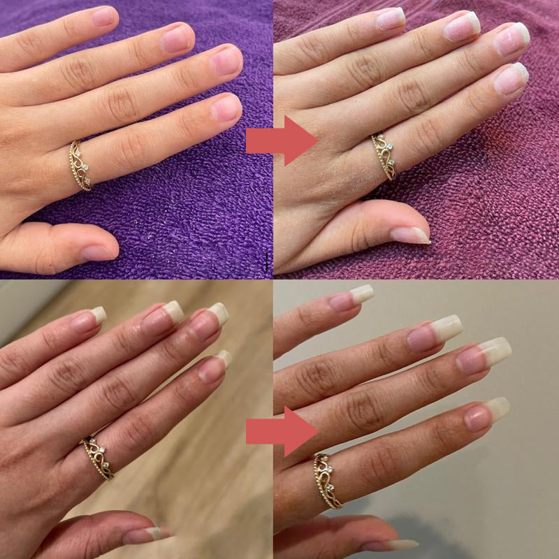 NailGrowth™ – Hydraterende & versterkende formule met vitamine E & biotine, 5 g [50% Korting]