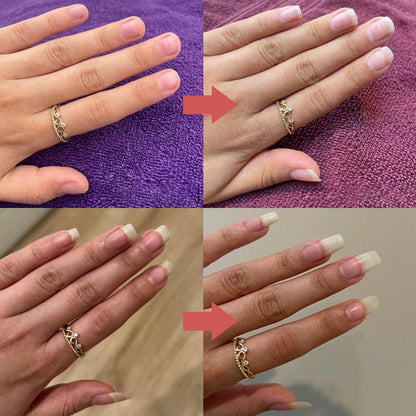 NailGrowth™ – Hydraterende & versterkende formule met vitamine E & biotine, 5 g [50% Korting]