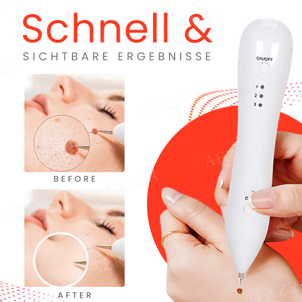 50% Korting | LuminSkin™ - Zeg vaarwel tegen vlekken [Laatste dag korting]