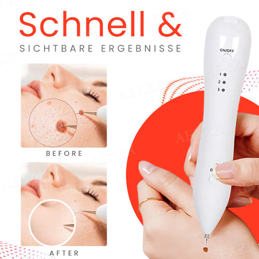 50% Korting | LuminSkin™ - Zeg vaarwel tegen vlekken [Laatste dag korting]