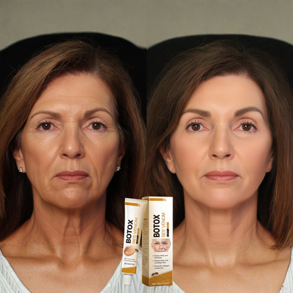 Apiluxe™ Bijengif Jeugdcrème – Anti-Aging Crème voor Strakke & Gladde Huid [1+1 Gratis]