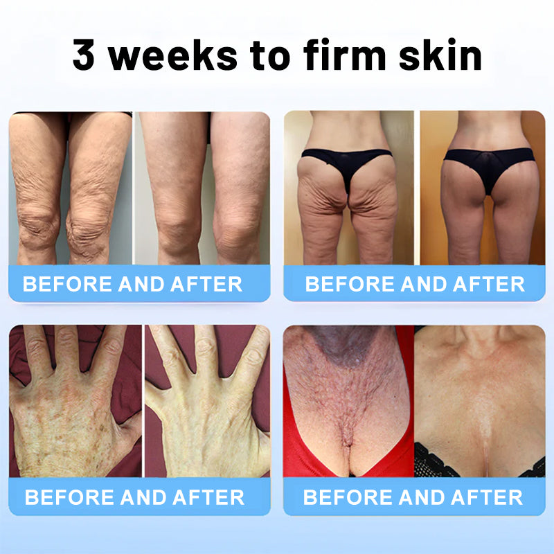 Venomi™ – Luxueuze lifting stick met bijengif & peptiden [1 + 1 Gratis]