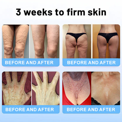 Venomi™ – Luxueuze lifting stick met bijengif & peptiden [1 + 1 Gratis]