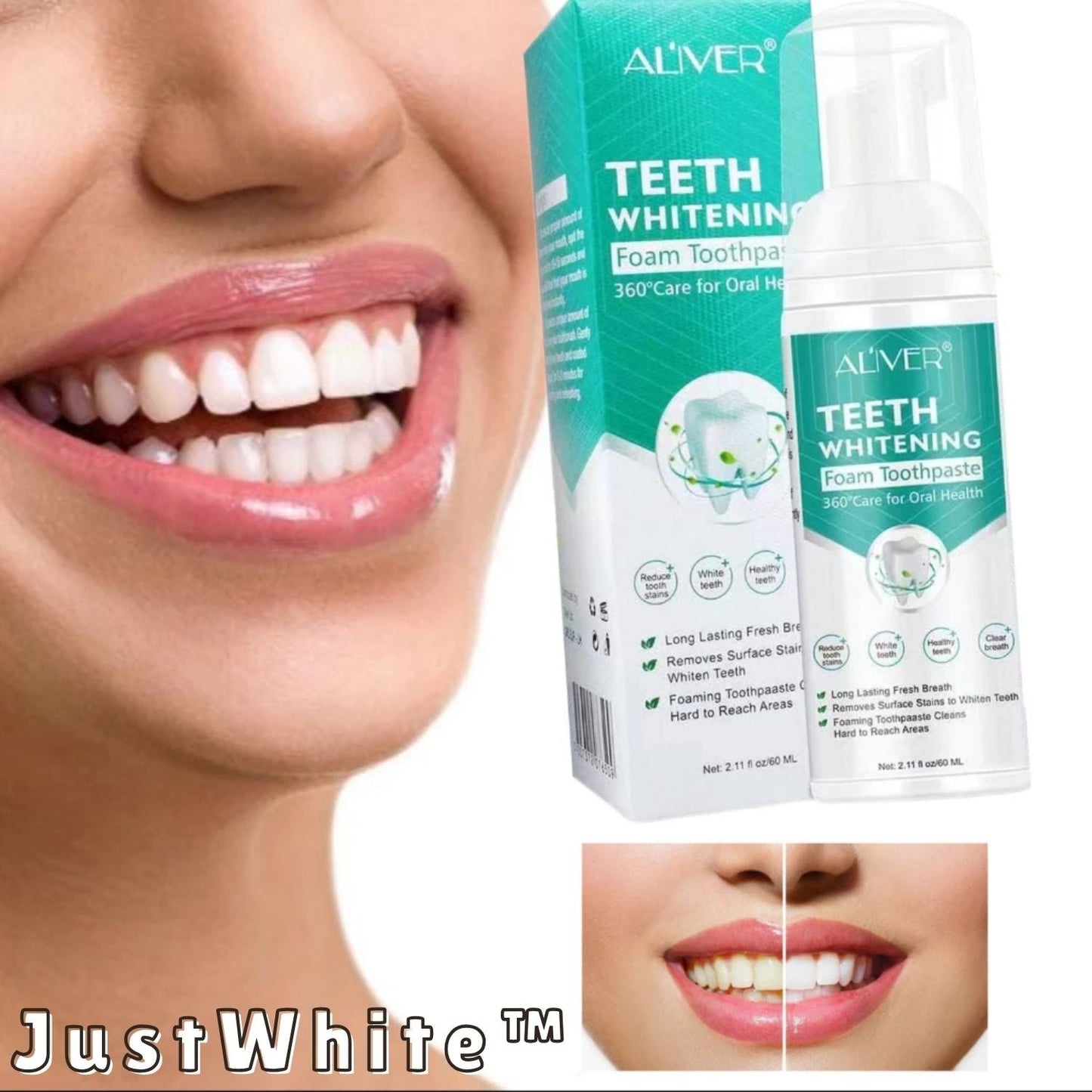 JustWhite™ – Verwijdert vlekken & verhelderend, frisse adem & natuurlijk veilig [1 + 1 Gratis]