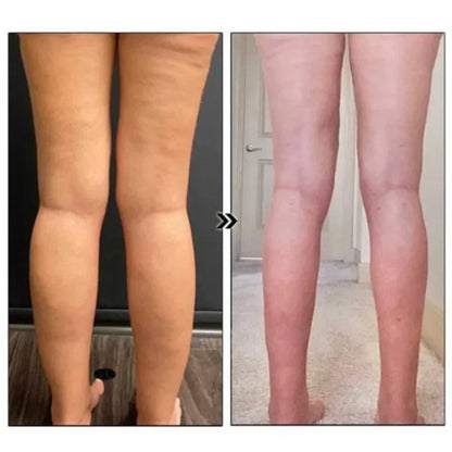 1 + 1 Paar | EarWave™ Magnetische Therapie-Oorbellen [Laatste Dag Korting]