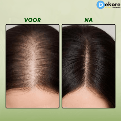 AuraRoot™ – Organische Rozemarijn Shampoo Voor Vol Haar [50% Korting]