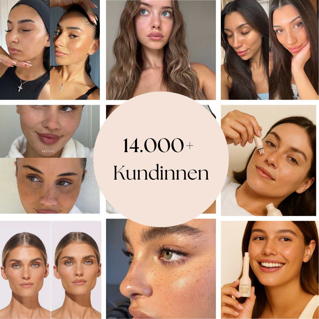SpeckleTouch™ – Speels & opvallend beauty-accent [50% korting]