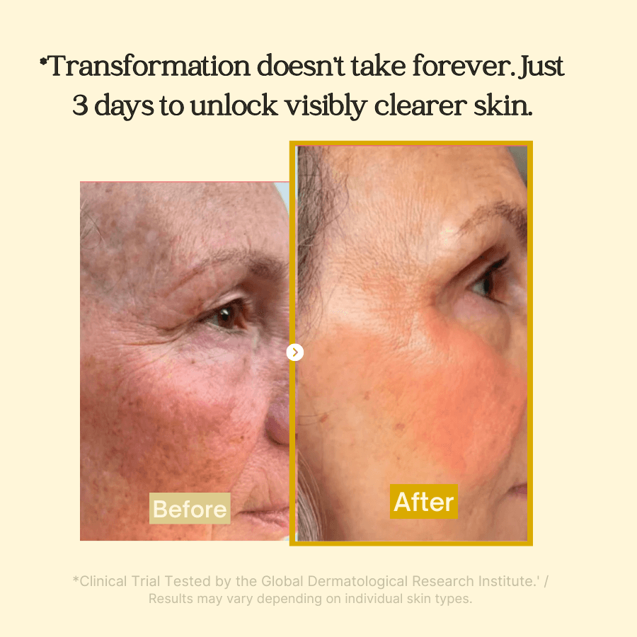 BrightMask™ – Overnight-peelingmasker met collageen, kurkuma en kojinezuur voor een stralende huid [50% Korting]