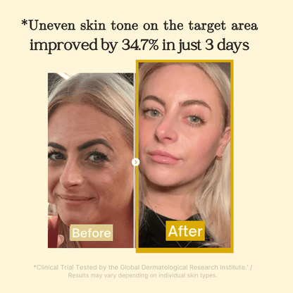 LumeSkin™ Verhelderende Nachtmasker tegen Pigmentvlekken [2+2 Gratis]