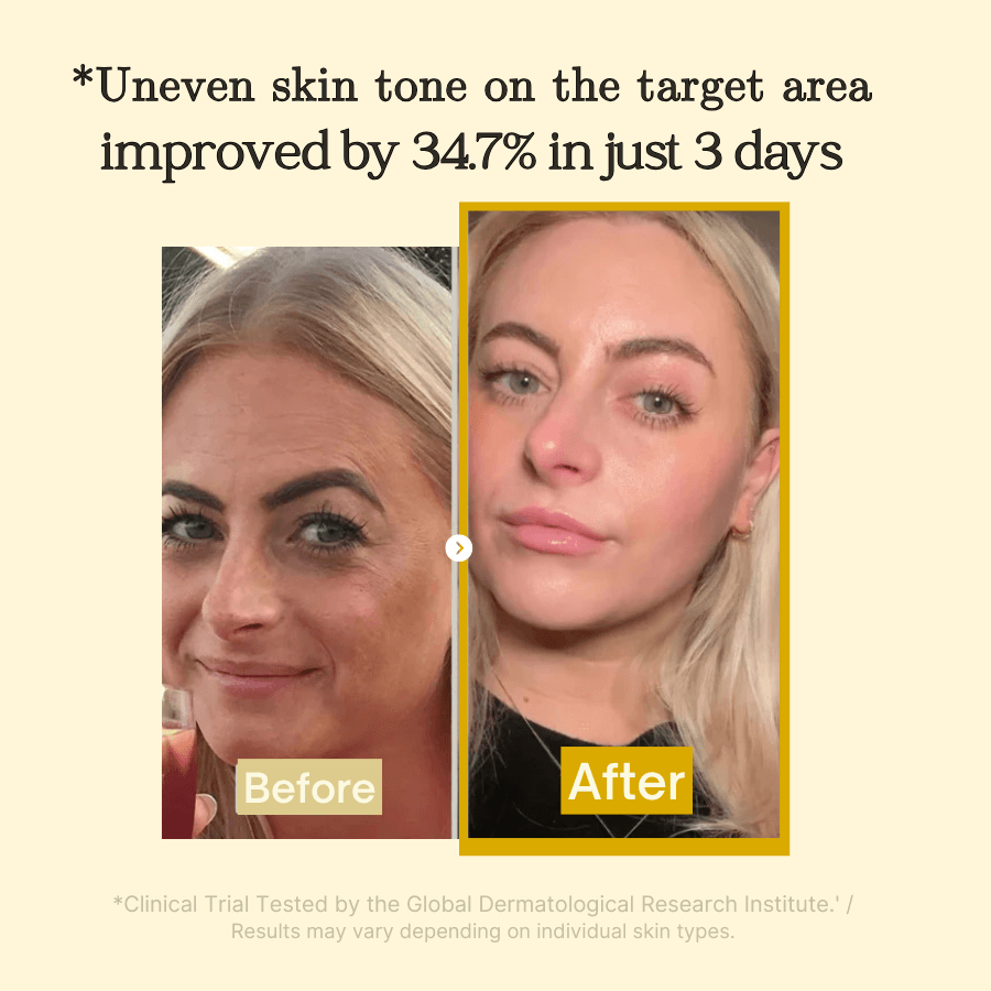 BrightMask™ – Overnight-peelingmasker met collageen, kurkuma en kojinezuur voor een stralende huid [50% Korting]