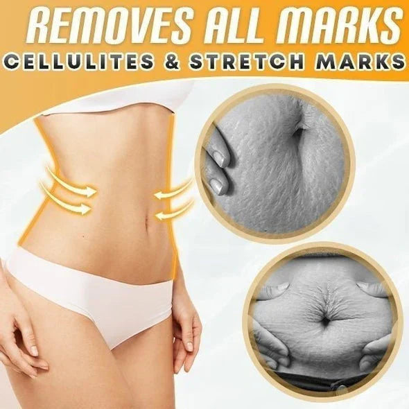 BellyDrain™ – Natuurlijke oliën voor veilige cellulitisverbranding [1 + 1 Gratis]