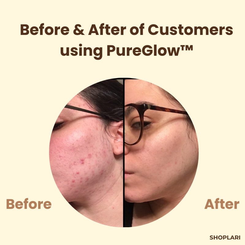 PureGlow™ Black Tea Masker – Diepte Reiniging & Antioxidanten Verzorging