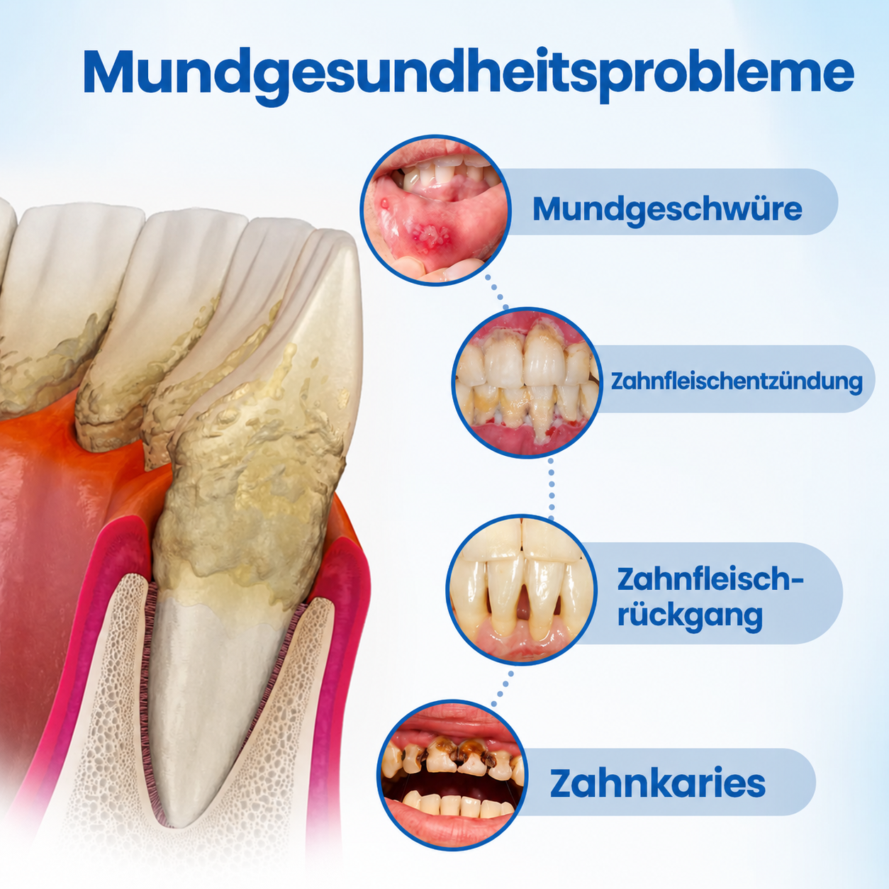 SmileHap – Tandbeschermingsserum voor stralend mooie tanden [50% korting]