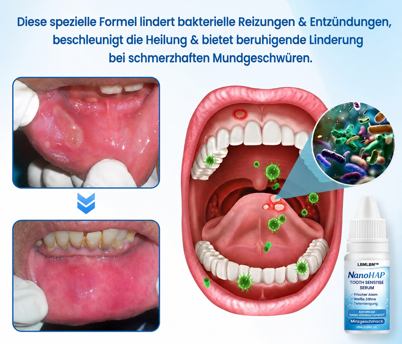 SmileHap – Tandbeschermingsserum voor stralend mooie tanden [50% korting]