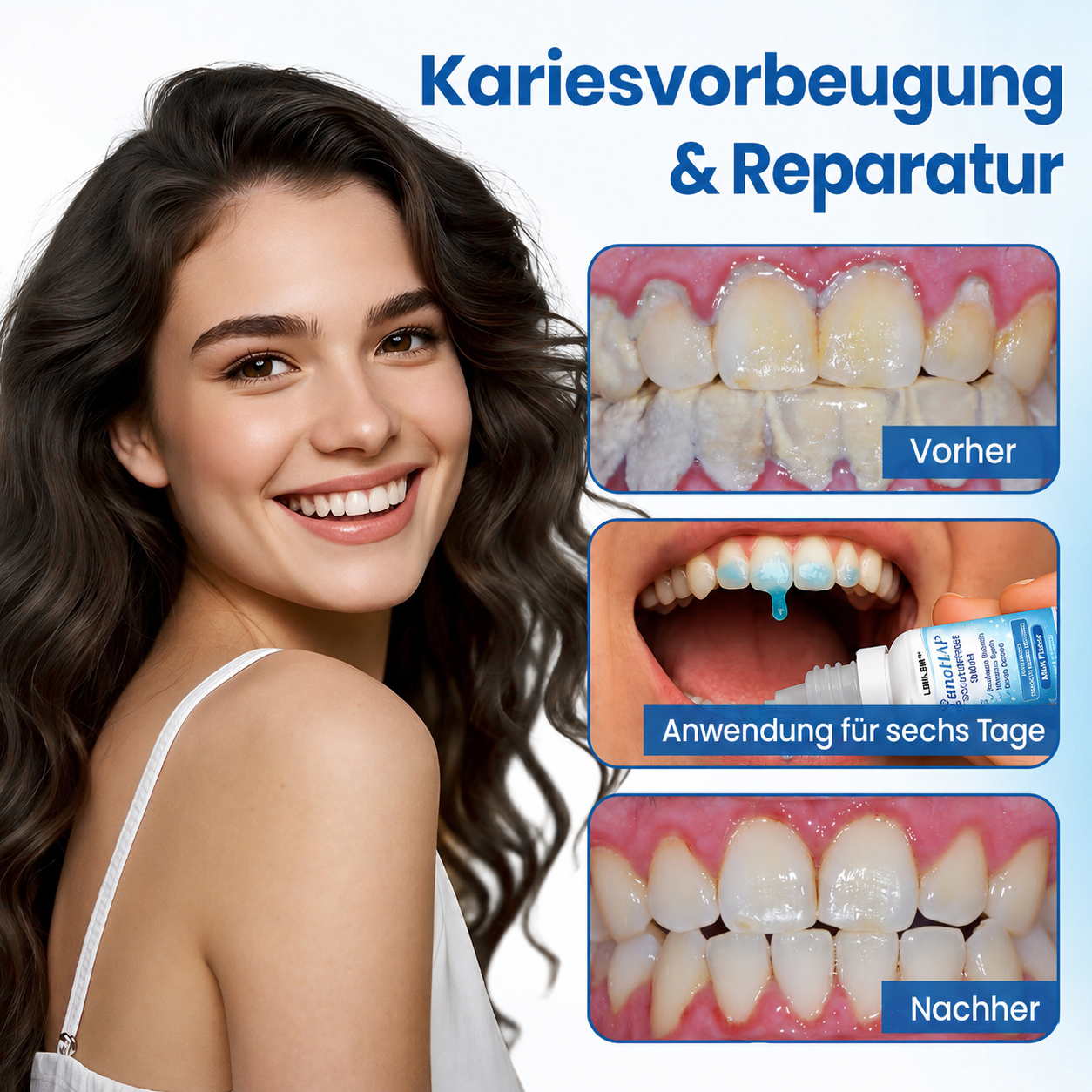 SmileHap – Tandbeschermingsserum voor stralend mooie tanden [50% korting]
