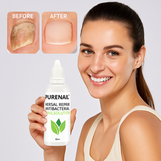 PureNail – Natuurlijke Nagelverzorging voor Gezonde & Mooie Nagels [50% Korting]