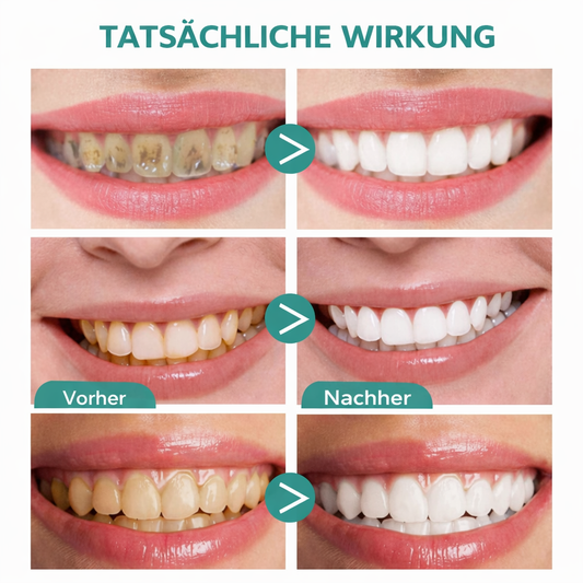 Aliver – Tandblekende schuimtandpasta voor stralend witte tanden [1 + 1 Gratis]
