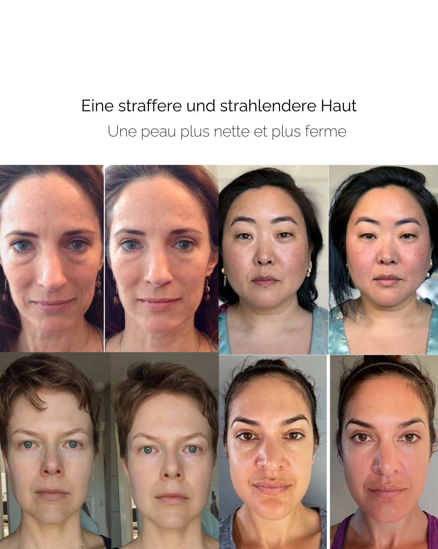 SkinRoll™ – Anti-rimpel schoonheidstool voor een gladde, stralende en jeugdige huid [50% Korting]