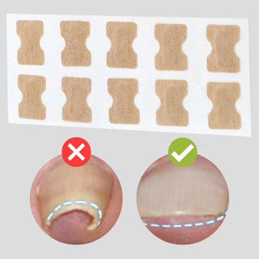 FinePatches™ – Correctiepleisters voor mooie, sterke en gezonde nagels [50% Korting]