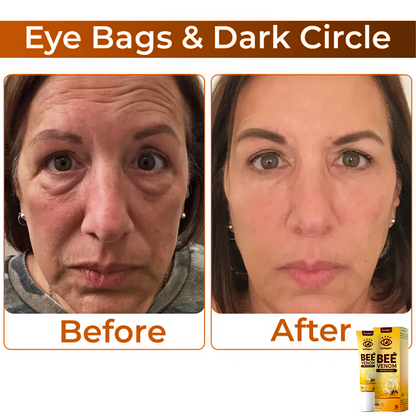 BeeVenom™ – Oogcrème met Bijengif voor Stralende Jeugdige Huid [1 + 1 Gratis]