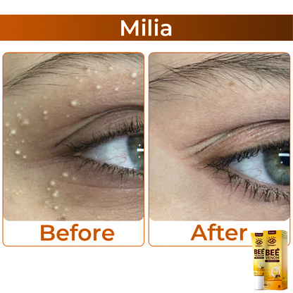 BeeVenom™ – Oogcrème met Bijengif voor Stralende Jeugdige Huid [1 + 1 Gratis]