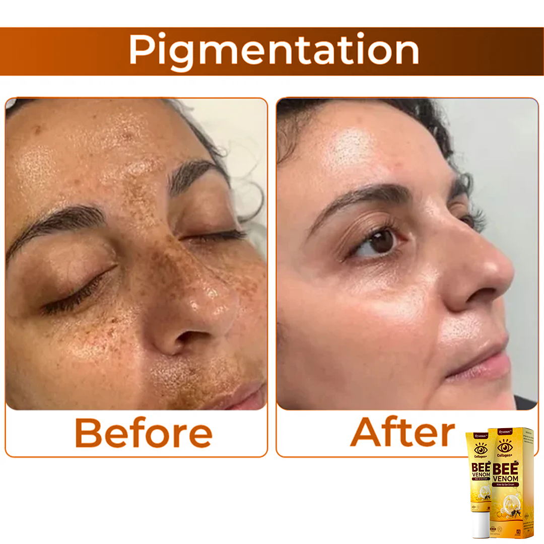 BeeVenom™ – Oogcrème met Bijengif voor Stralende Jeugdige Huid [1 + 1 Gratis]